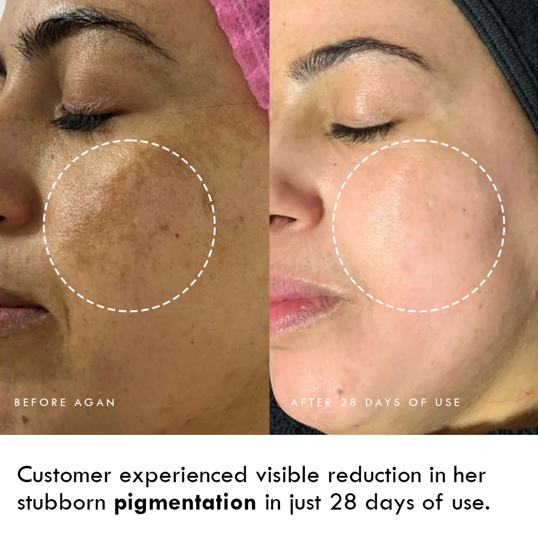 Alpha Arbutin & Shea Butter Leave - Brightening Facial Mousse - AS GOOD AS NEW