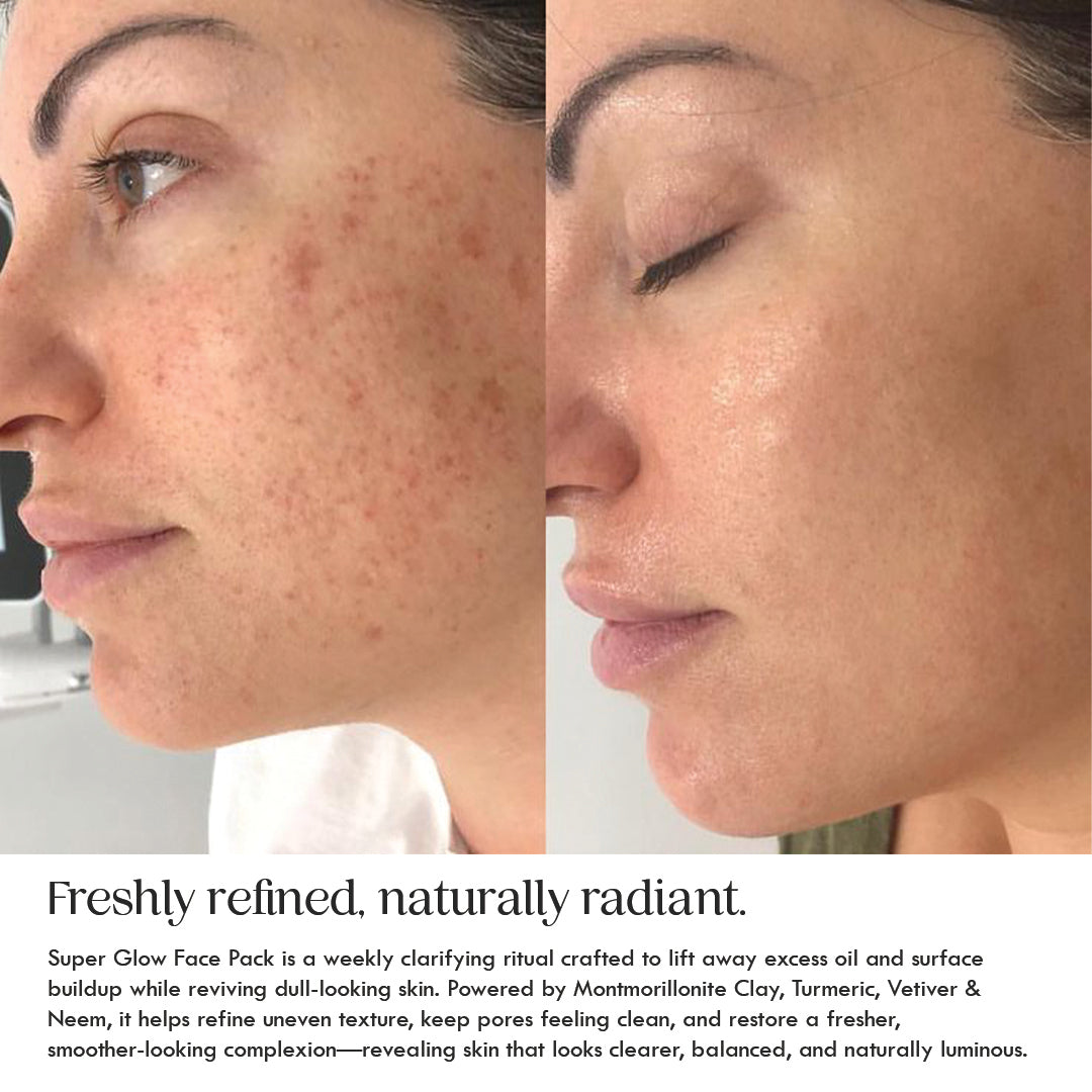 Superglow Radiance Mask