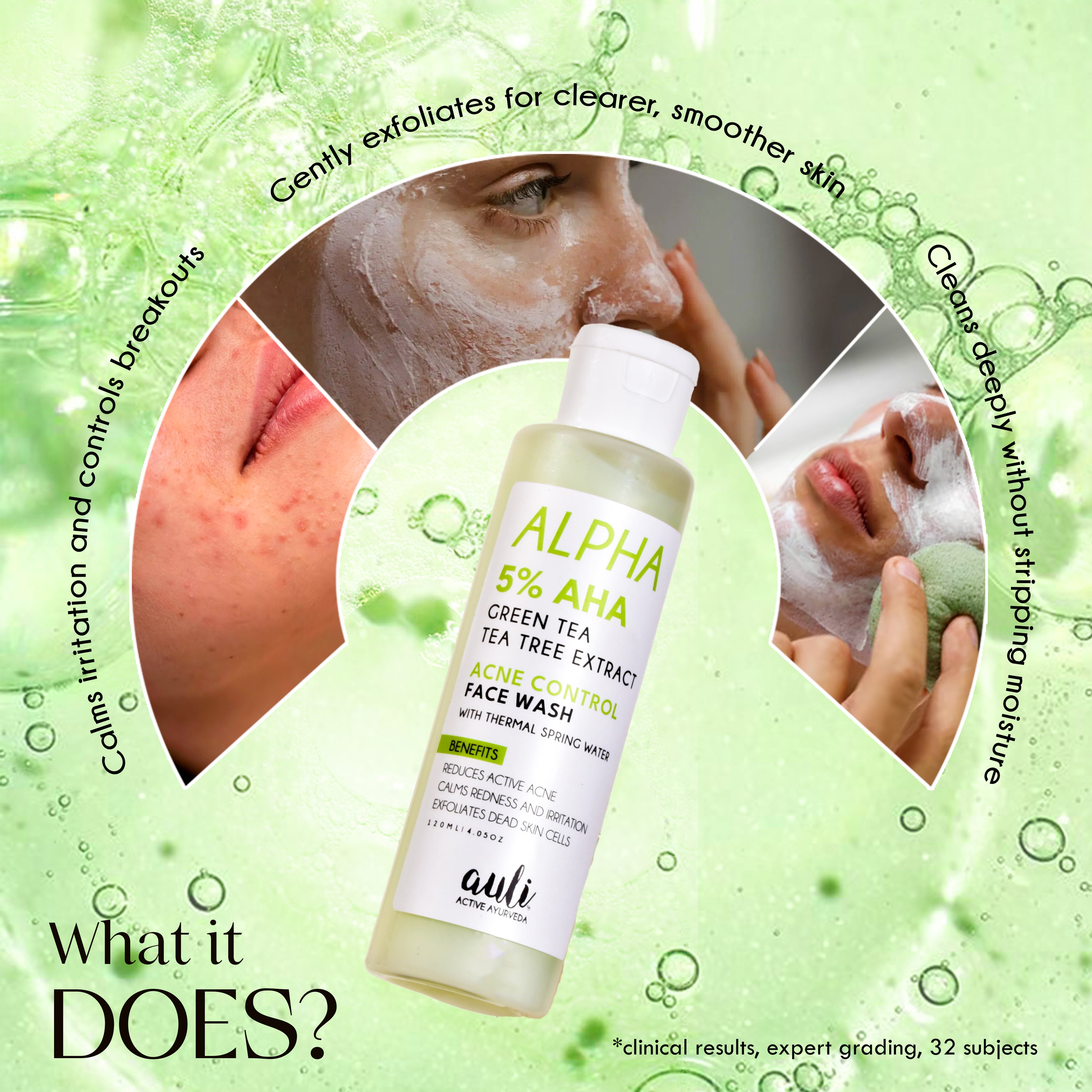 AHA-5% Acne-Control Face Wash - ALPHA