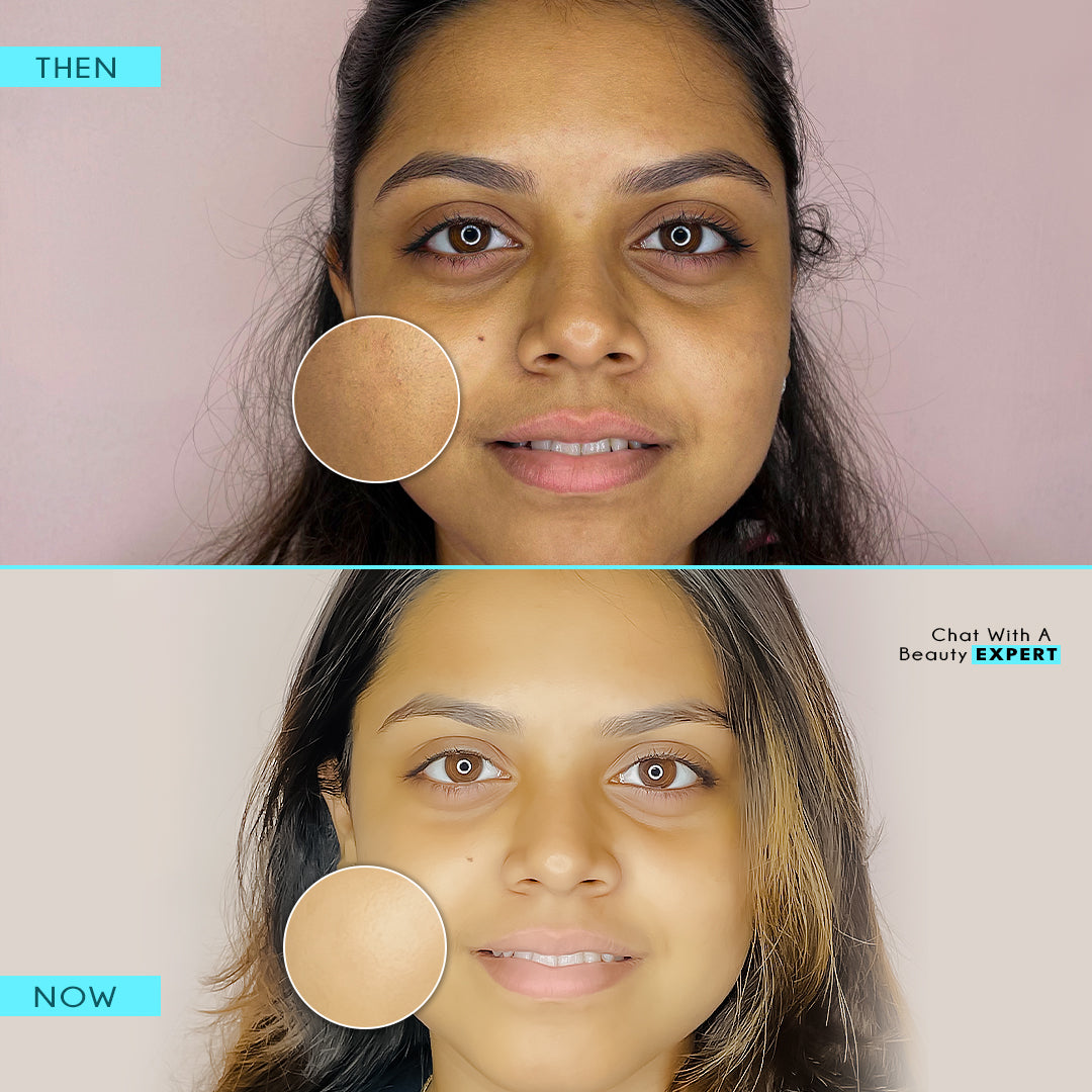 Oil Control Mattifying Gel - MAGIC POTION