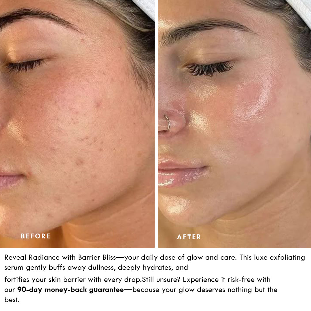Barrier Protection Serum-Elixir - BARRIER BLISS