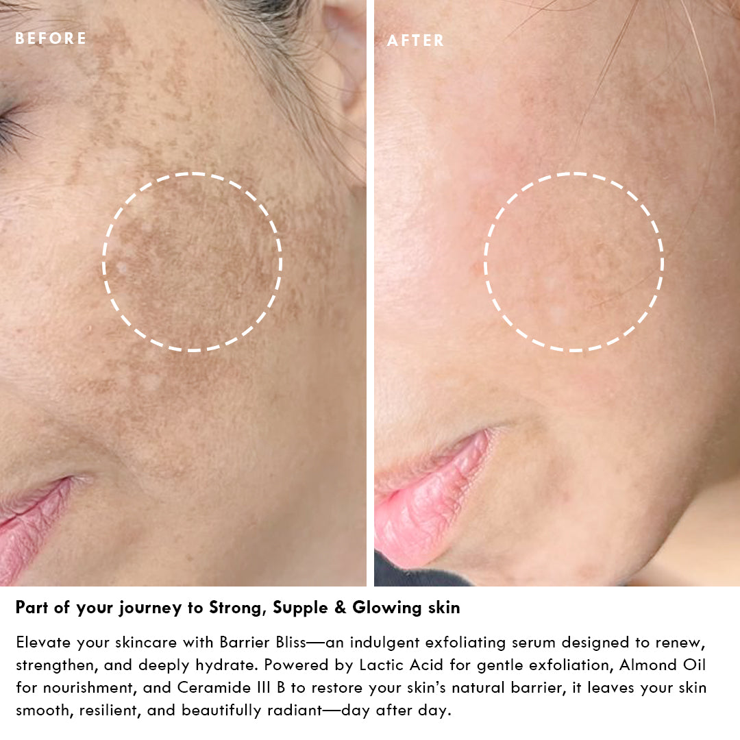 Barrier Protection Serum-Elixir - BARRIER BLISS