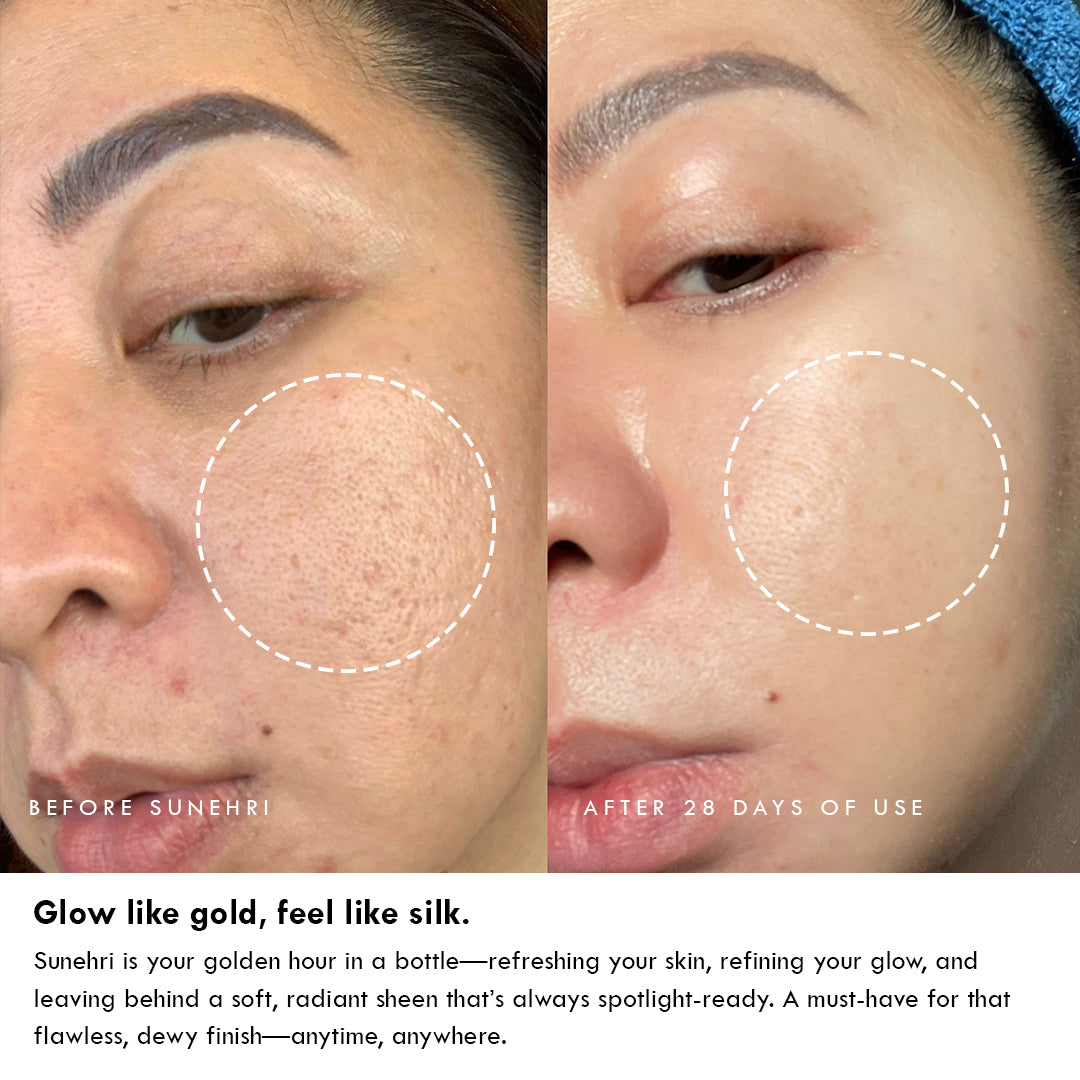 Sunehri Glow Booster Serum Mist – 24H Hydration & Glass Skin Finish | Auli Active Ayurveda