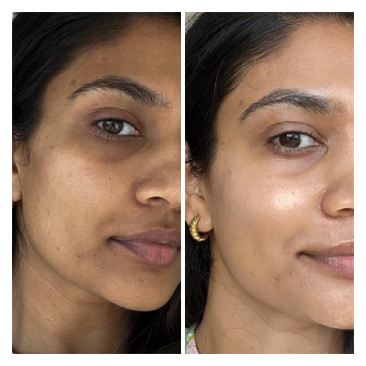 Superglow Radiance Mask
