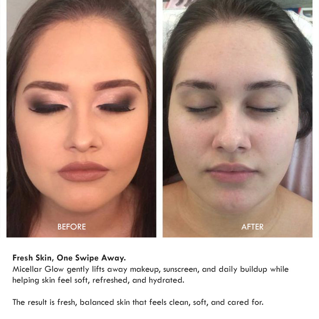 Micellar Glow