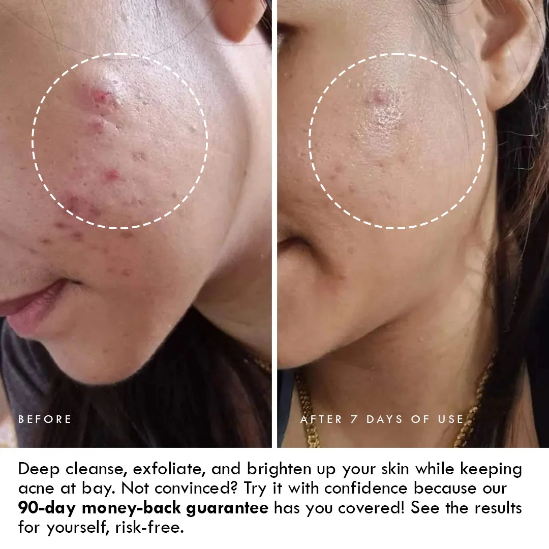 Organica Acne Cleanser with 2% Salicylic Acid, Niacinamide Beads, Centella & Saffron
