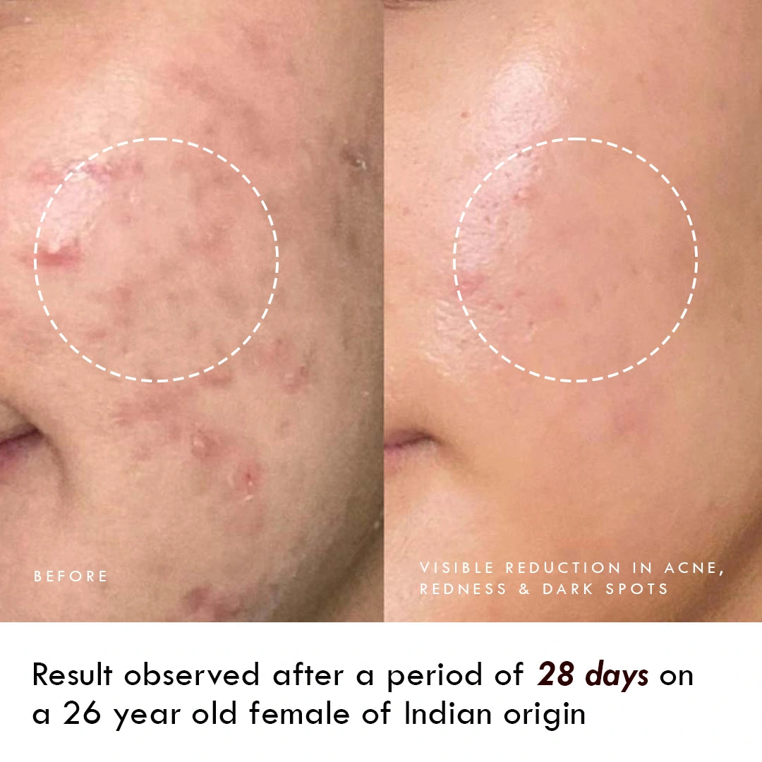 Niacinamide & 24k Gold Flakes Hydrator - MAGIC POTION GOLD