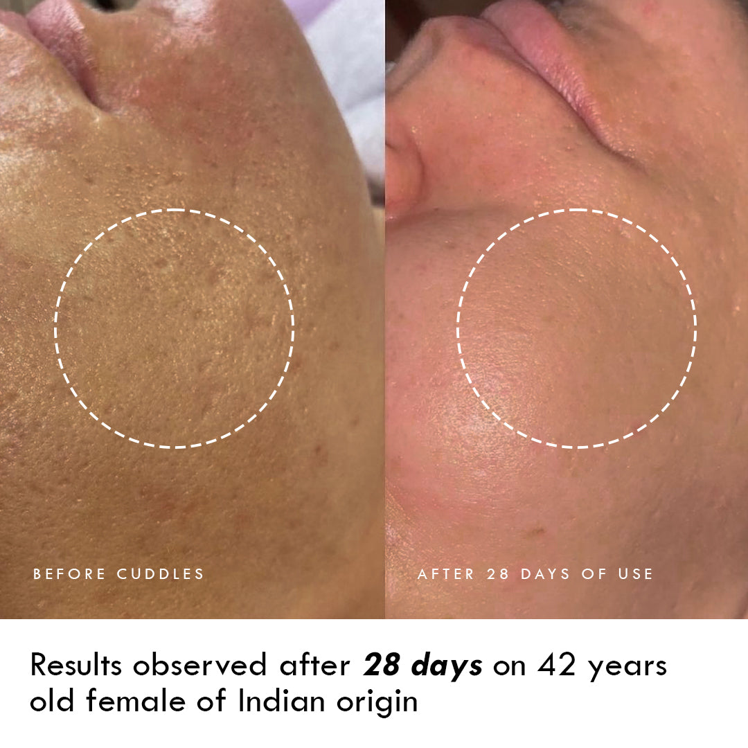 Night Cream with Ceramide IIIB & Glutathione – CUDDLES