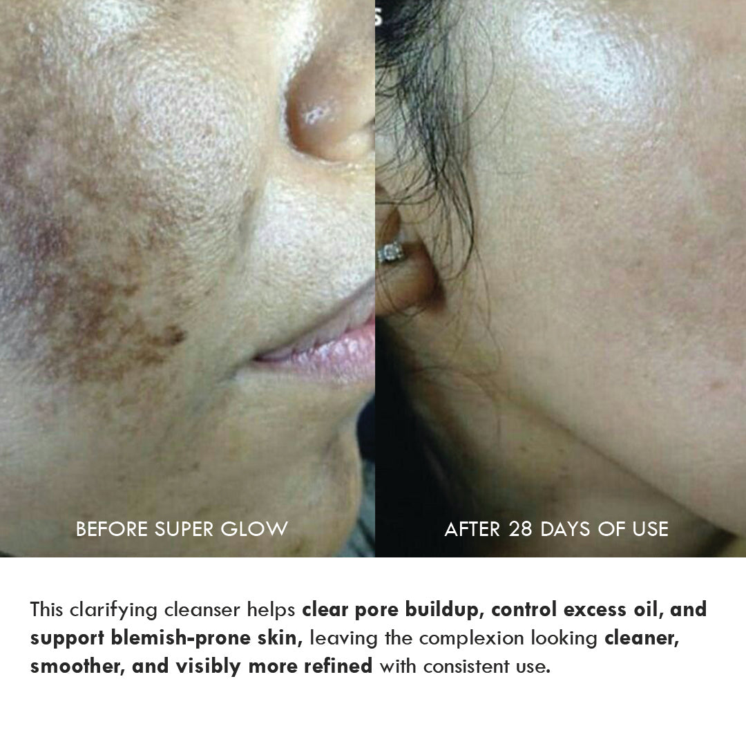 Super Glow Anti-Acne Face Wash