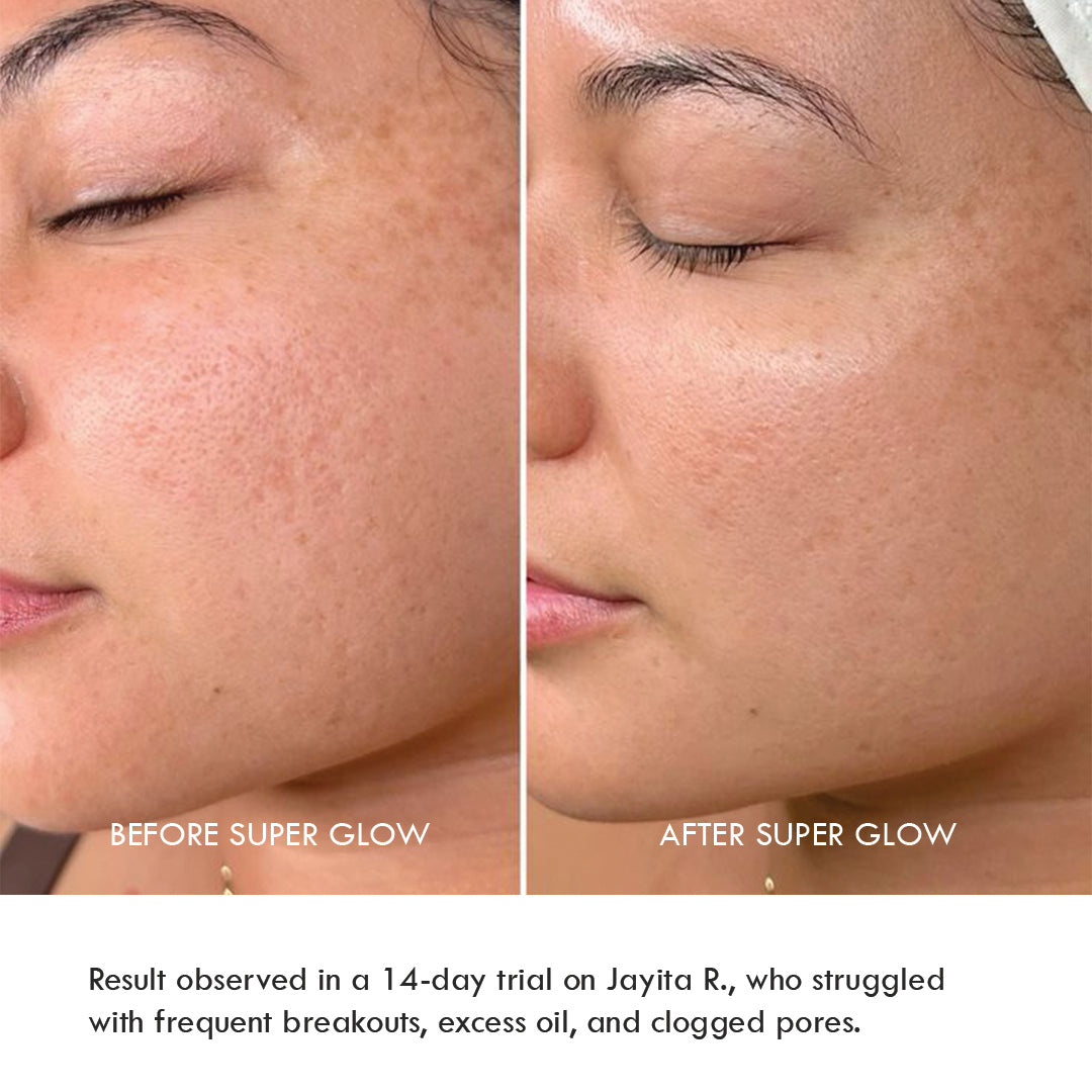 Super Glow Anti-Acne Face Wash